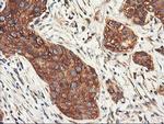 PFKP Antibody in Immunohistochemistry (Paraffin) (IHC (P))