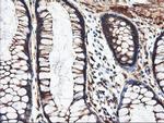 PFKP Antibody in Immunohistochemistry (Paraffin) (IHC (P))