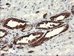 PFKP Antibody in Immunohistochemistry (Paraffin) (IHC (P))