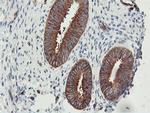 PFKP Antibody in Immunohistochemistry (Paraffin) (IHC (P))