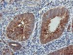 PFKP Antibody in Immunohistochemistry (Paraffin) (IHC (P))