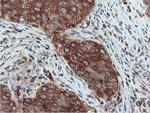 PFKP Antibody in Immunohistochemistry (Paraffin) (IHC (P))