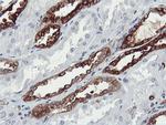 PFKP Antibody in Immunohistochemistry (Paraffin) (IHC (P))