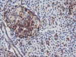 PFKP Antibody in Immunohistochemistry (Paraffin) (IHC (P))