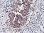 PFKP Antibody in Immunohistochemistry (Paraffin) (IHC (P))