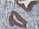 PFKP Antibody in Immunohistochemistry (Paraffin) (IHC (P))