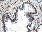 PFKP Antibody in Immunohistochemistry (Paraffin) (IHC (P))