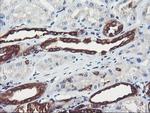 PFKP Antibody in Immunohistochemistry (Paraffin) (IHC (P))