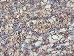 PFKP Antibody in Immunohistochemistry (Paraffin) (IHC (P))