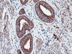 PFKP Antibody in Immunohistochemistry (Paraffin) (IHC (P))