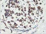 PFKP Antibody in Immunohistochemistry (Paraffin) (IHC (P))