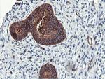 PFKP Antibody in Immunohistochemistry (Paraffin) (IHC (P))