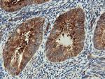 PFKP Antibody in Immunohistochemistry (Paraffin) (IHC (P))