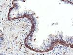 PFKP Antibody in Immunohistochemistry (Paraffin) (IHC (P))