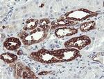 PFKP Antibody in Immunohistochemistry (Paraffin) (IHC (P))