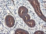 PFKP Antibody in Immunohistochemistry (Paraffin) (IHC (P))