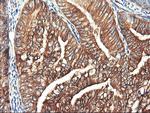 PFKP Antibody in Immunohistochemistry (Paraffin) (IHC (P))