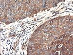 PFKP Antibody in Immunohistochemistry (Paraffin) (IHC (P))