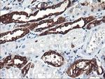 PFKP Antibody in Immunohistochemistry (Paraffin) (IHC (P))