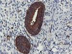 PFKP Antibody in Immunohistochemistry (Paraffin) (IHC (P))