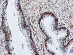 PFKP Antibody in Immunohistochemistry (Paraffin) (IHC (P))