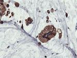 PFKP Antibody in Immunohistochemistry (Paraffin) (IHC (P))