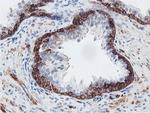 PFKP Antibody in Immunohistochemistry (Paraffin) (IHC (P))