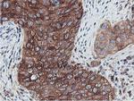 PFKP Antibody in Immunohistochemistry (Paraffin) (IHC (P))