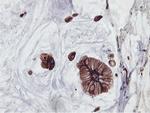 PFKP Antibody in Immunohistochemistry (Paraffin) (IHC (P))