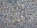 PFKP Antibody in Immunohistochemistry (Paraffin) (IHC (P))