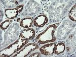 PFKP Antibody in Immunohistochemistry (Paraffin) (IHC (P))