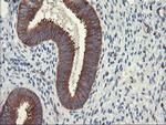 PFKP Antibody in Immunohistochemistry (Paraffin) (IHC (P))