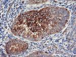 PFKP Antibody in Immunohistochemistry (Paraffin) (IHC (P))