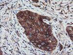 PFKP Antibody in Immunohistochemistry (Paraffin) (IHC (P))