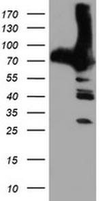 PFKP Antibody in Western Blot (WB)