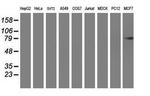 PFKP Antibody in Western Blot (WB)