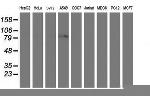 PFKP Antibody in Western Blot (WB)