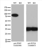 PFKP Antibody in Western Blot (WB)