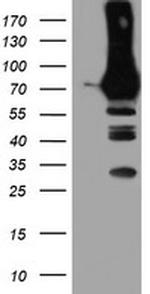 PFKP Antibody in Western Blot (WB)