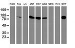 PFKP Antibody in Western Blot (WB)