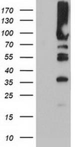 PFKP Antibody in Western Blot (WB)