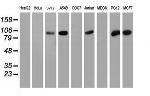 PFKP Antibody in Western Blot (WB)