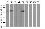 PFKP Antibody in Western Blot (WB)