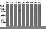 PFKP Antibody in Western Blot (WB)