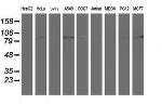 PFKP Antibody in Western Blot (WB)