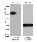 PFKP Antibody in Western Blot (WB)