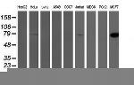 PFKP Antibody in Western Blot (WB)