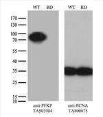 PFKP Antibody in Western Blot (WB)