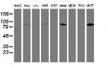 PFKP Antibody in Western Blot (WB)