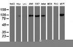 PFKP Antibody in Western Blot (WB)